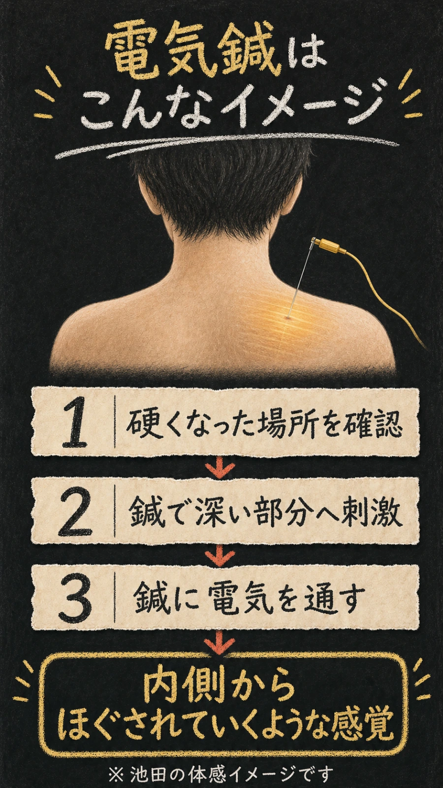 首肩の硬くなった場所を確認し、鍼で深い部分へ刺激して電気を通すという、筆者の体感イメージを示したスマホ用の縦長図